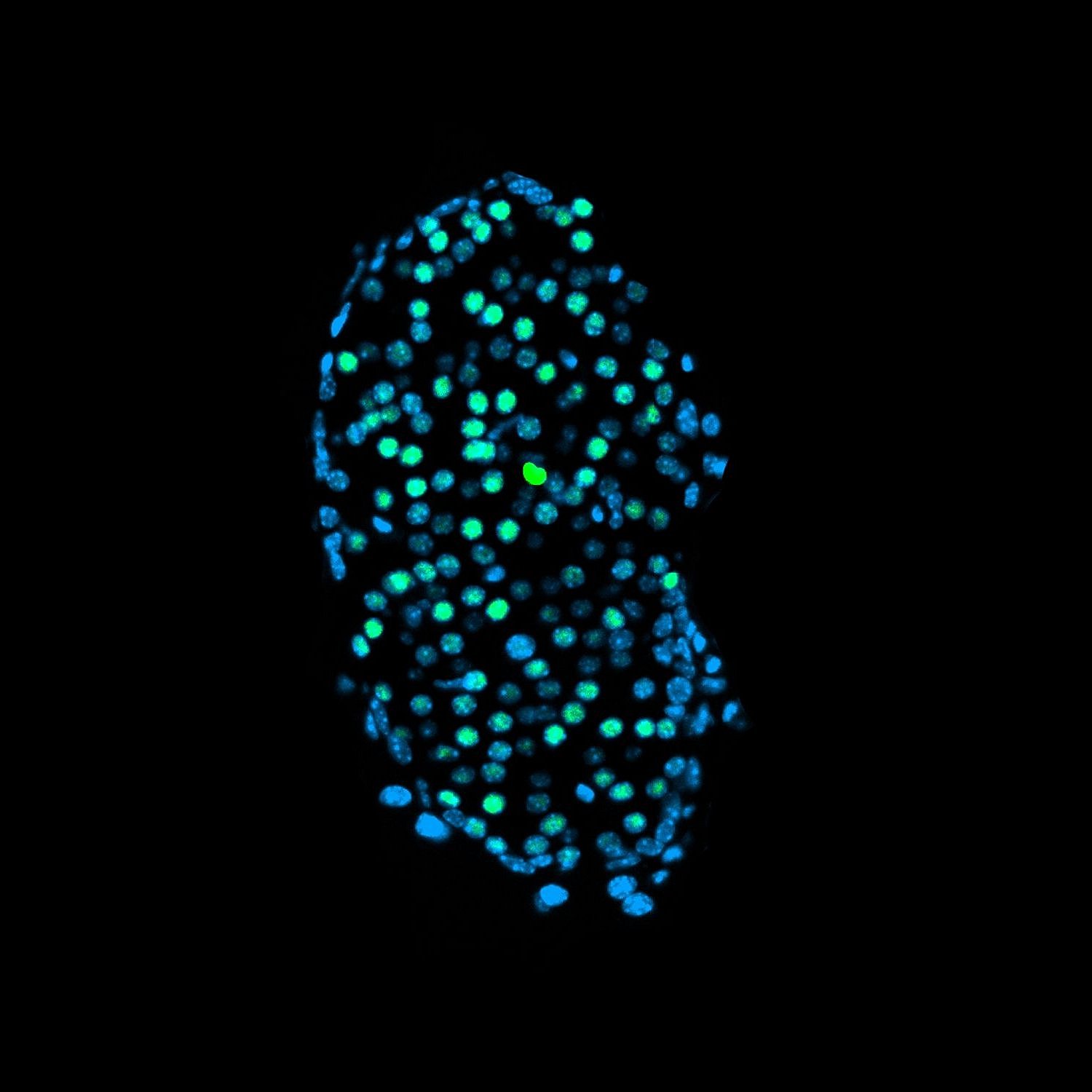 This shows an accumulation of beta cells from the pancreas of an adolescent mouse.  Compared to the older mouse, there are noticeably fewer beta cells visible here.