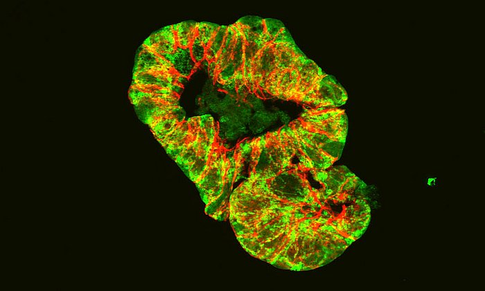 Microscopic image of an intestinal organoid