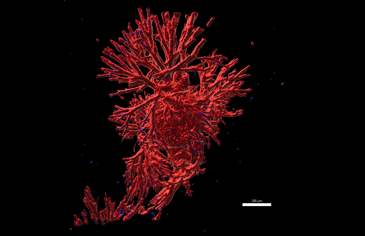 Sternartiges Tumor-Organoid mit kugelförmiger Mitte und zahlreichen Verästelungen. 