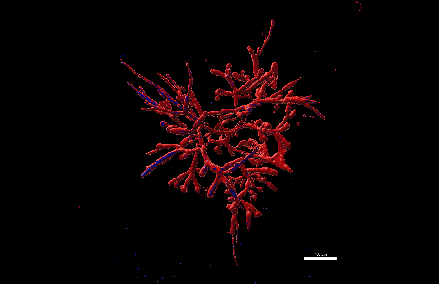 Pancreatic tumor organoid from the phenotype “TEBBO”.