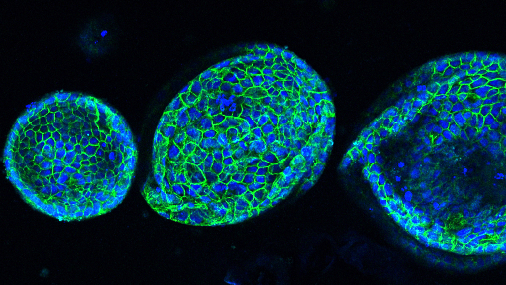 Classic, spheric pancreatic cancer organoids. 